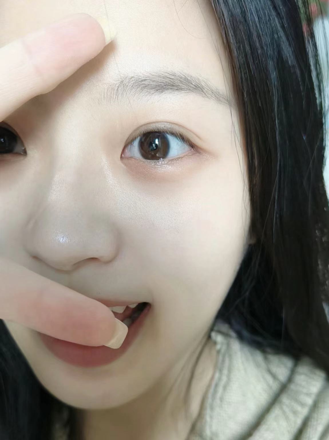 痘痘肌的拯救：告别痘痘，重拾光滑肌肤